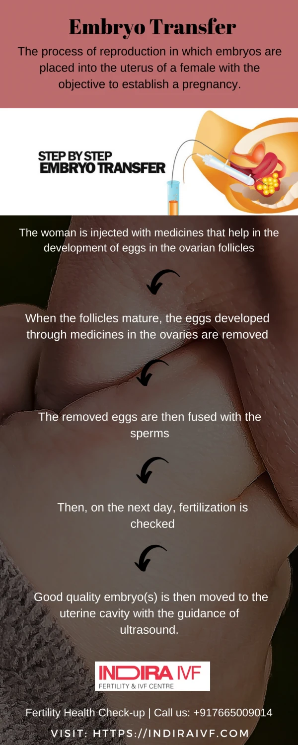 Process of embryo transfer - Indira IVF