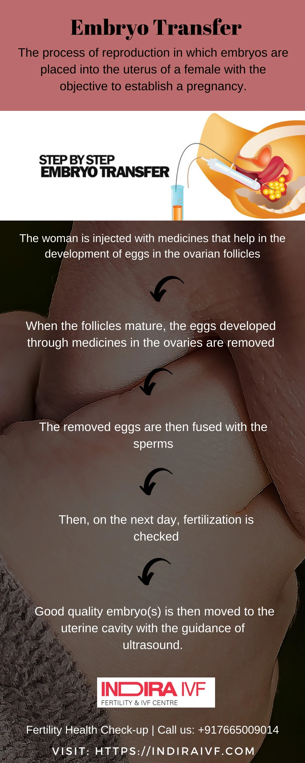 embryo transfer