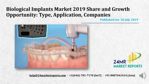 Biological Implants Market 2019 Share and Growth Opportunity Type, Application, Companies