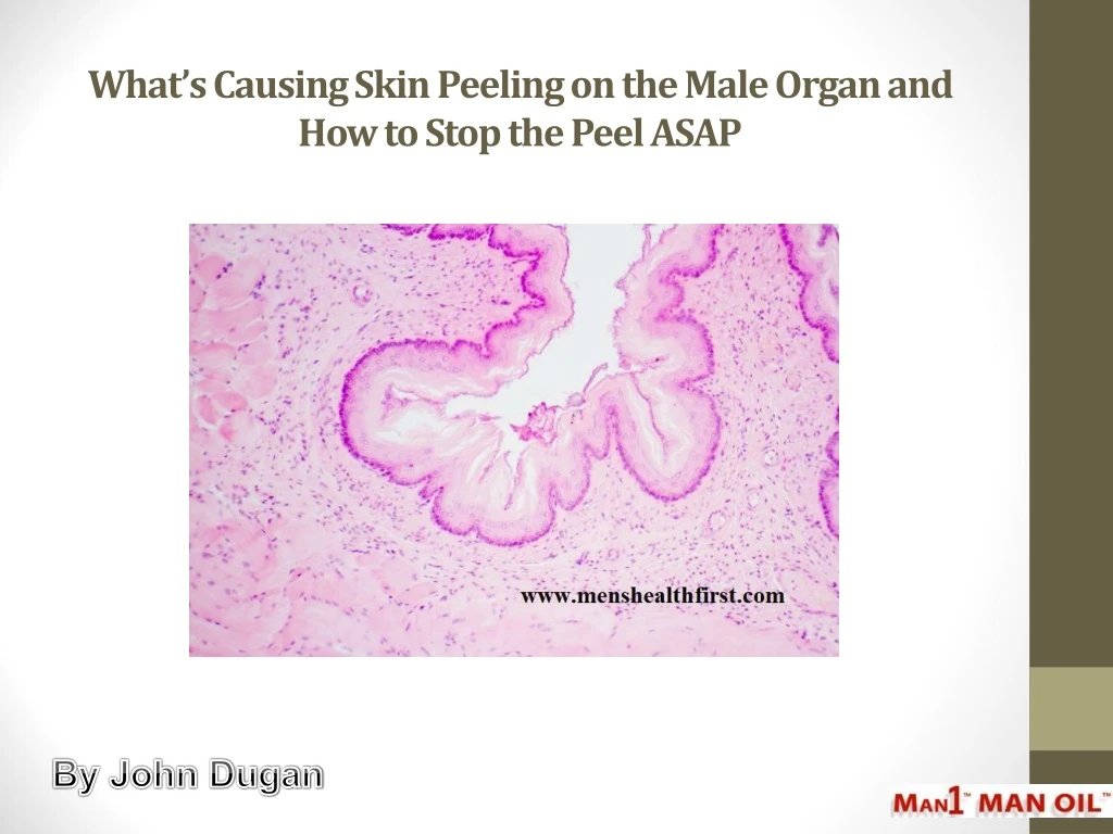 what s causing skin peeling on the male organ and how to stop the peel asap
