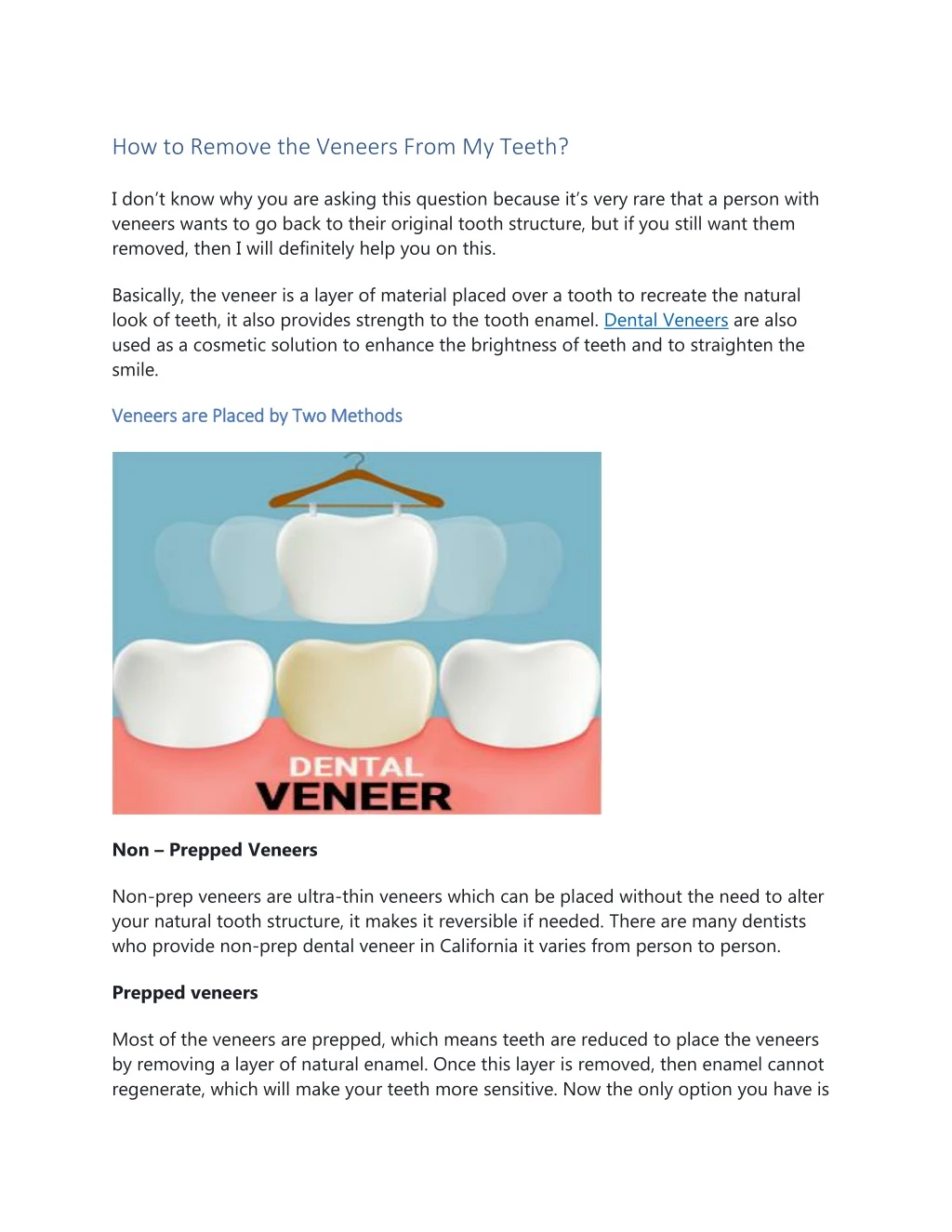 how to remove the veneers from my teeth