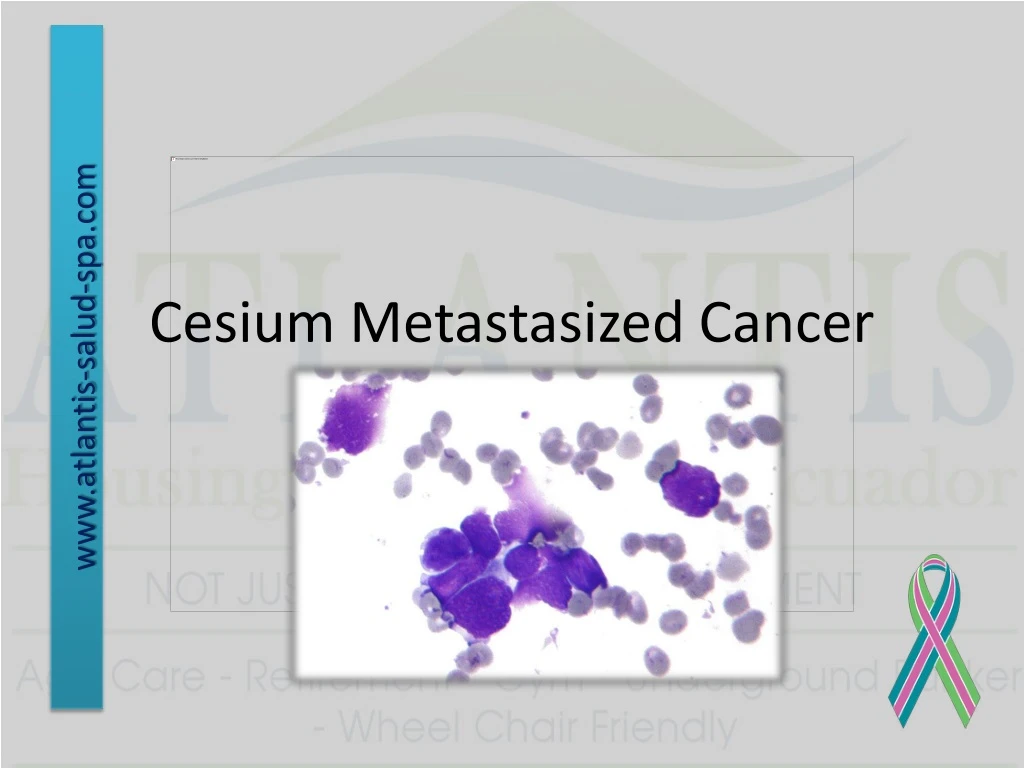 cesium metastasized cancer