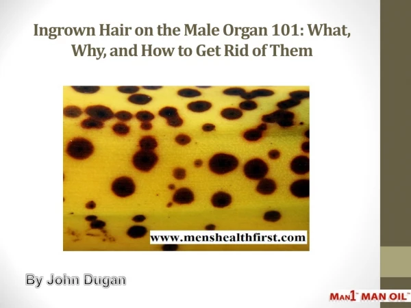 Ingrown Hair on the Male Organ 101: What, Why, and How to Get Rid of Them