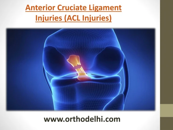 Anterior Cruciate Ligament Injuries (ACL Injuries)