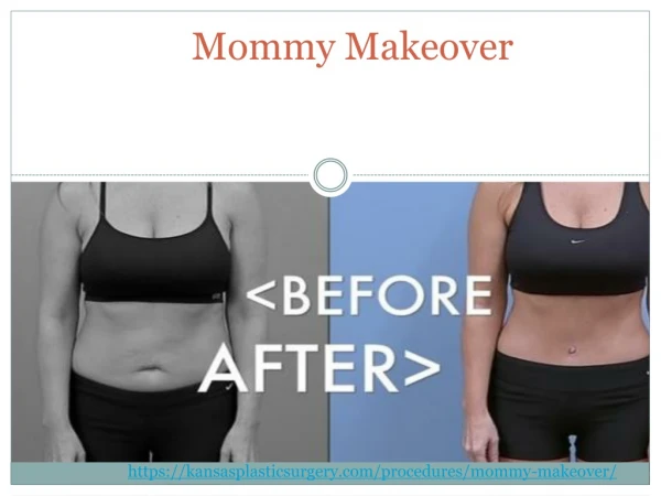 mommy makeover