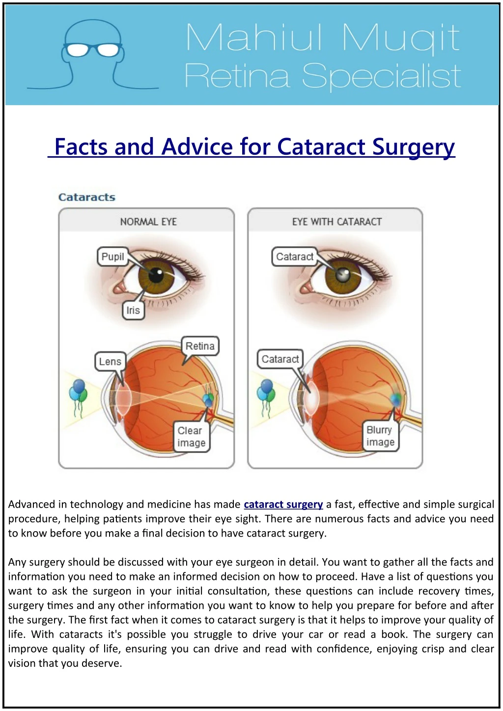facts and advice for cataract surgery