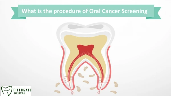 What is the procedure of Oral Cancer Screening