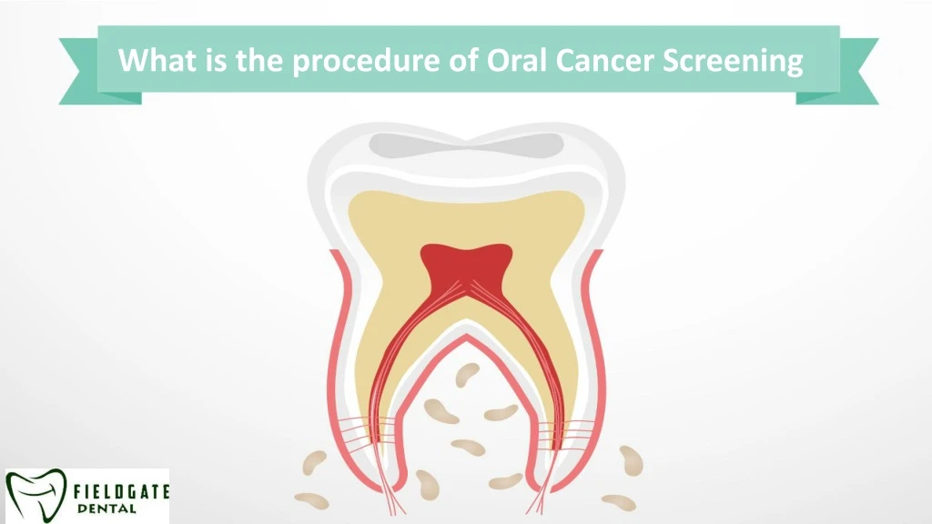 what is the procedure of oral cancer screening