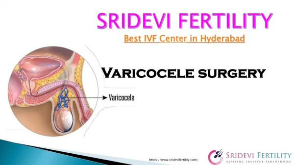 Varicocele Surgery in Hyderabad | Fertility Hospital in Hyderabad