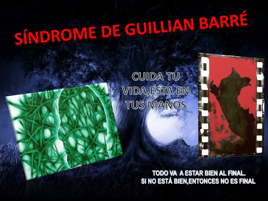 s ndrome de guillian barr