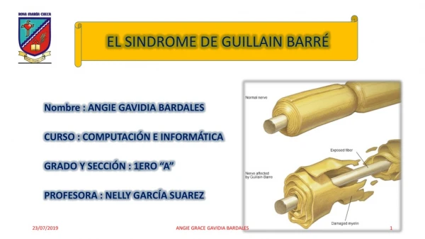 SÍNDROME DE GUILLAIN BARRÉ