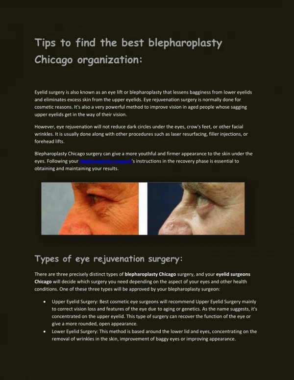 Tips to find the best blepharoplasty Chicago organization- Read here