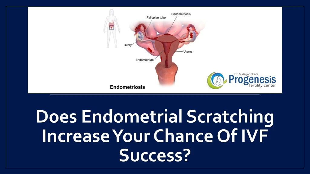 does endometrial scratching increase your chance of ivf success