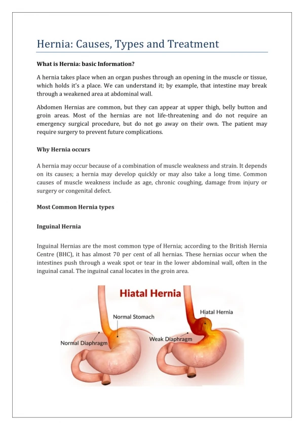Hernia : Causes, Types and Treatment