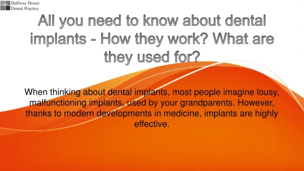 All you need to know about dental implants