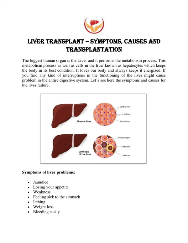Liver Transplant – symptoms, causes and transplantation