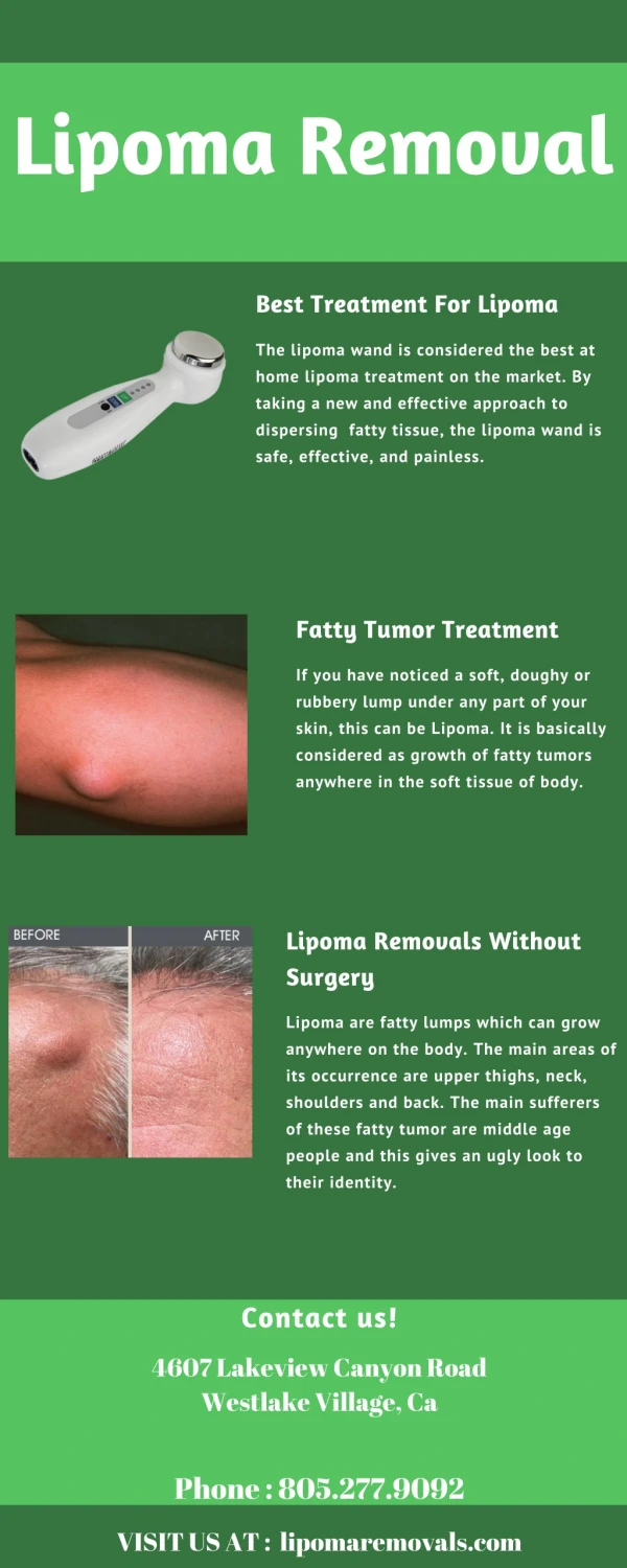 Lipoma Removal - Lipoma Wand