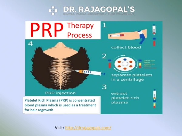 PRP Therapy Along With Hair Transplant Surgery In Gurgaon - Dr. RajaGopal's Clinic.