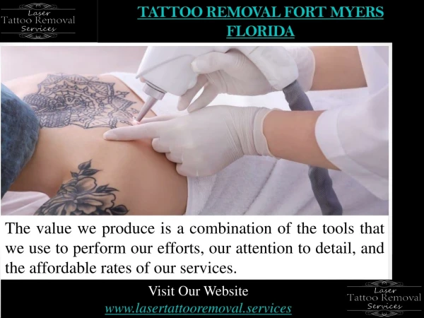 Tattoo Removal Fort Myers Florida