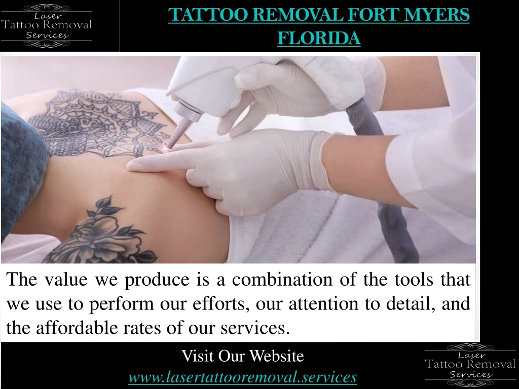 tattoo removal fort myers florida