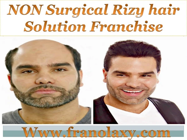 Rizy hair solution franchise