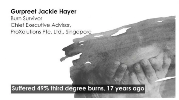 Burn Survivor Gurpreet Jackie Shares Her Story | Padanjali Ayurvedics
