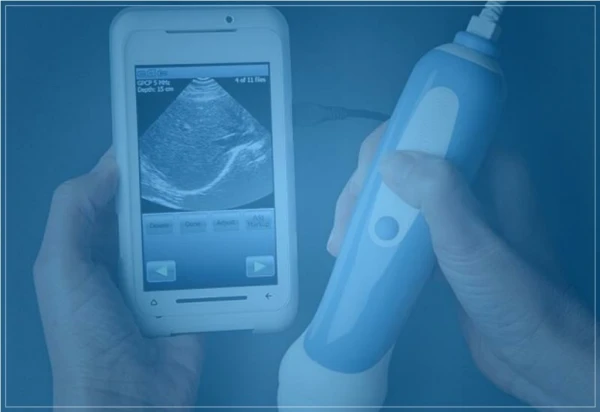 Purchase Easy to carry Wireless Portable Ultrasound and user-friendly diagnostic devices