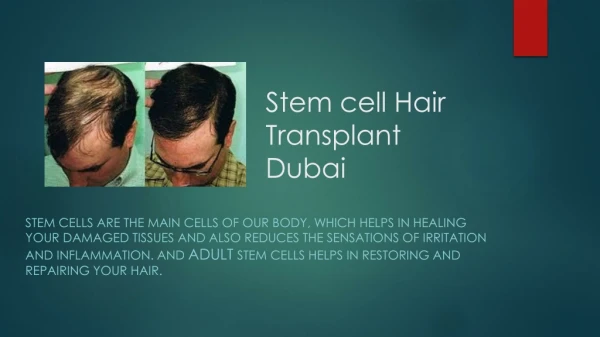 Stem cell Hair Transplant Dubai