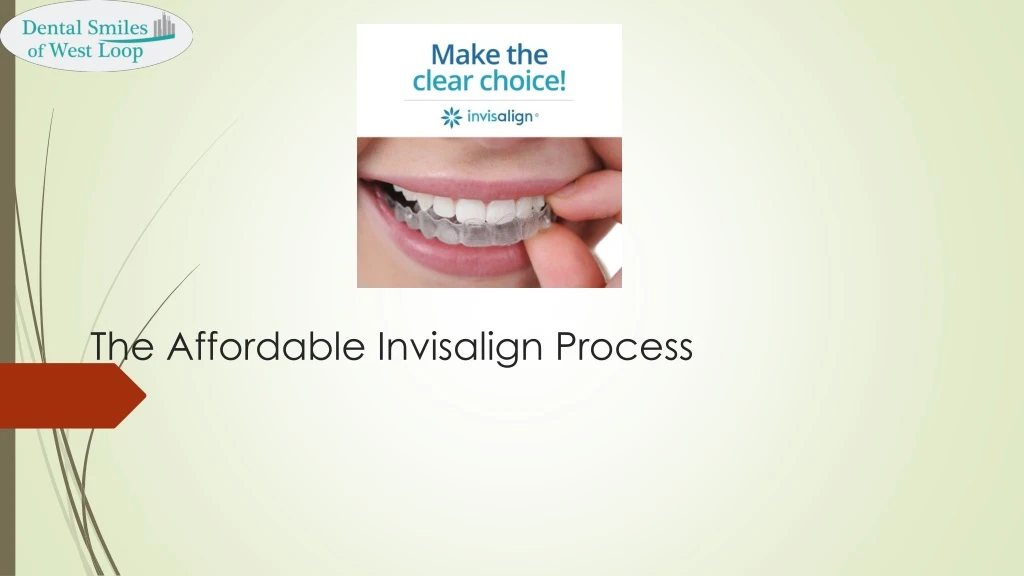 the affordable invisalign process