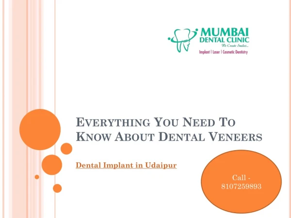 Everything You Need To Know About Dental Veneers