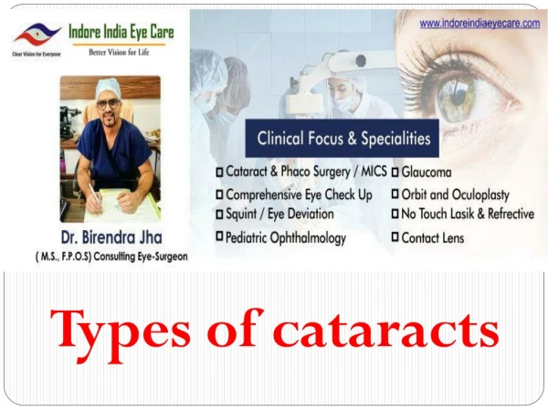 Types of cataracts