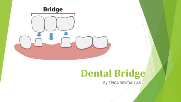 Dental Bridge | Epica Dental Lab