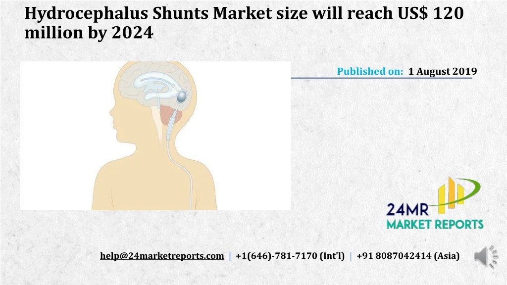 hydrocephalus shunts market size will reach us 120 million by 2024