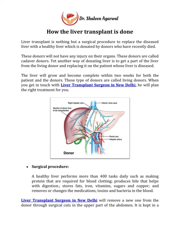 How the liver transplant is done