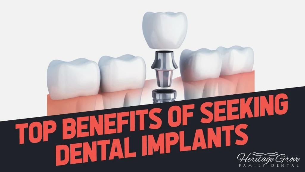 top benefits of seeking dental implants