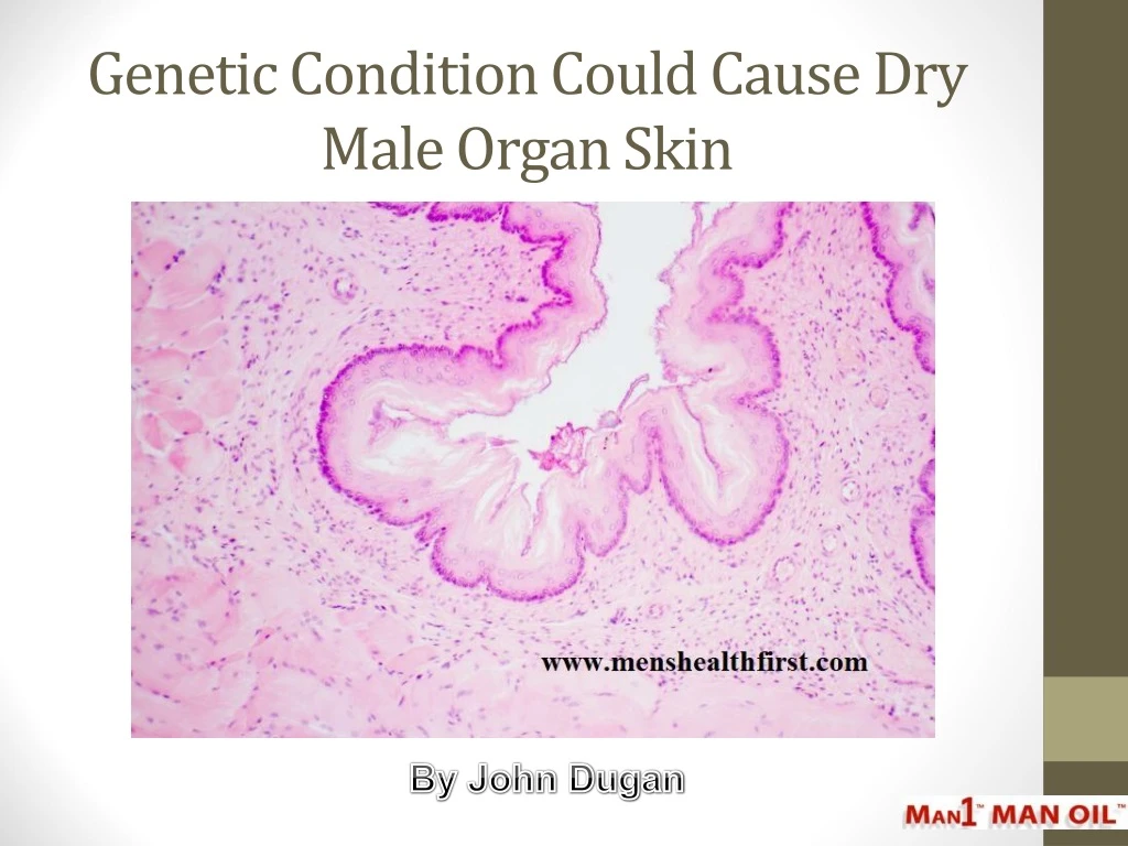 genetic condition could cause dry male organ skin