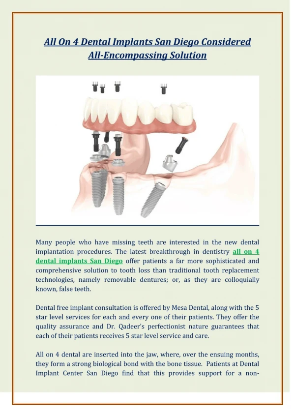 All On 4 Dental Implants San Diego Considered All-Encompassing Solution