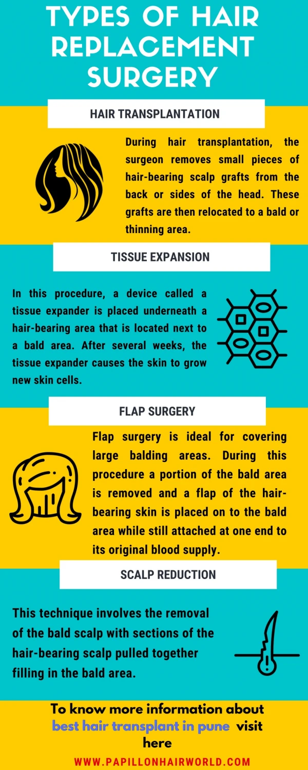 Types of Hair Replacement Surgery