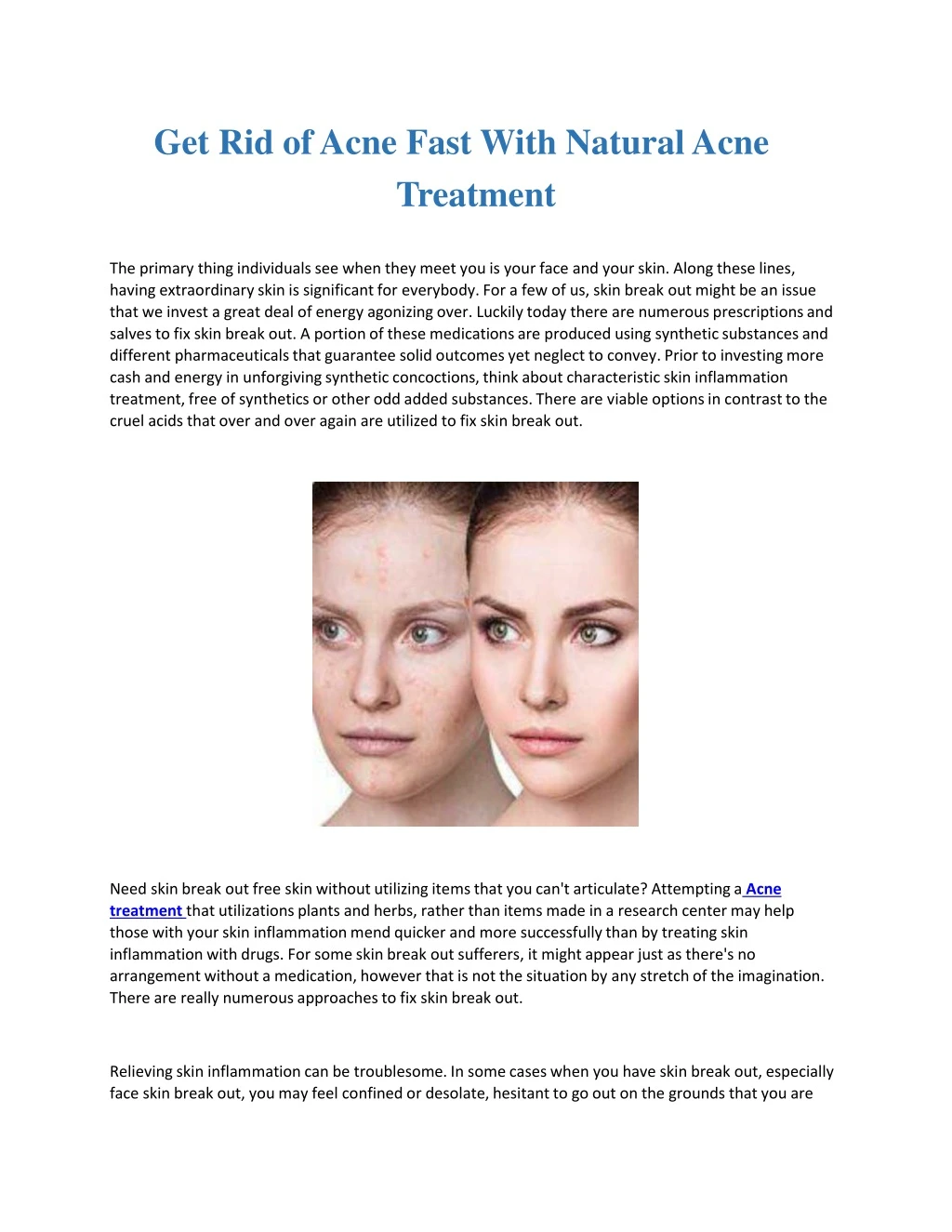 get rid of acne fast with natural acne treatment