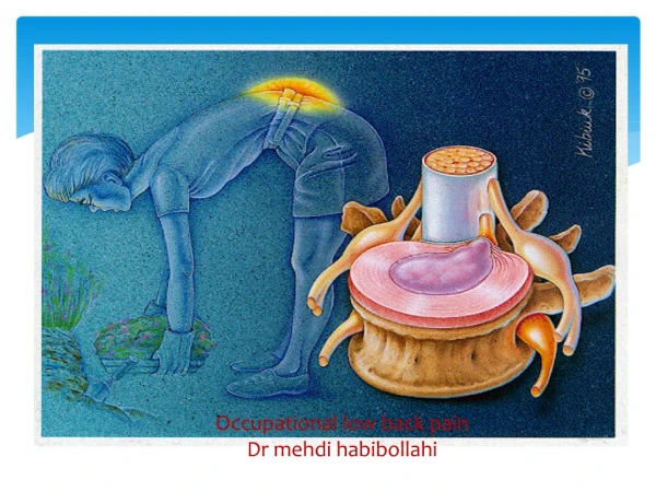 Occupational low back pain Dr mehdi habibollahi