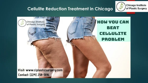 How you can beat cellulite problem?