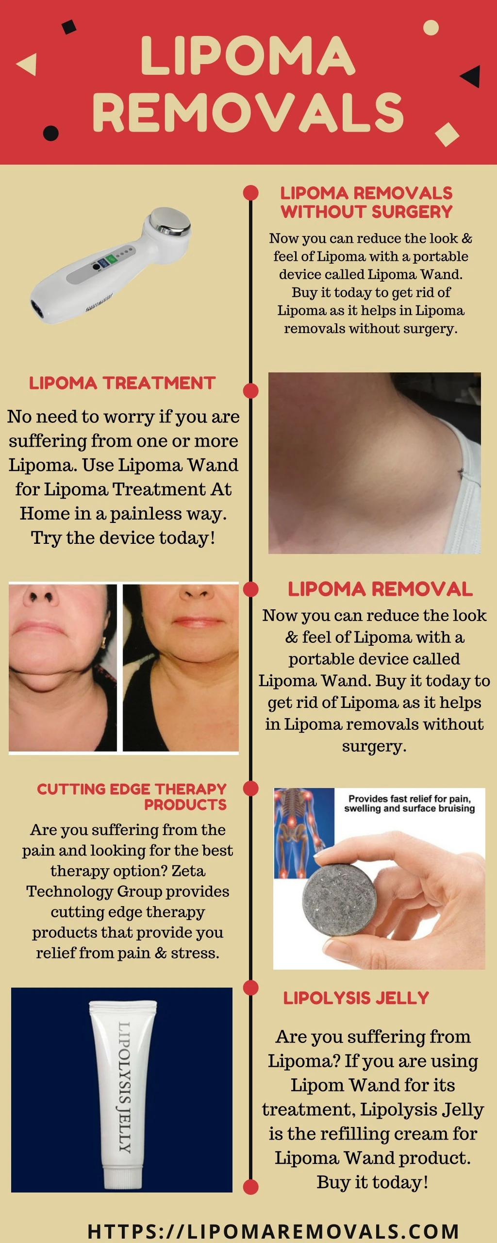 lipoma