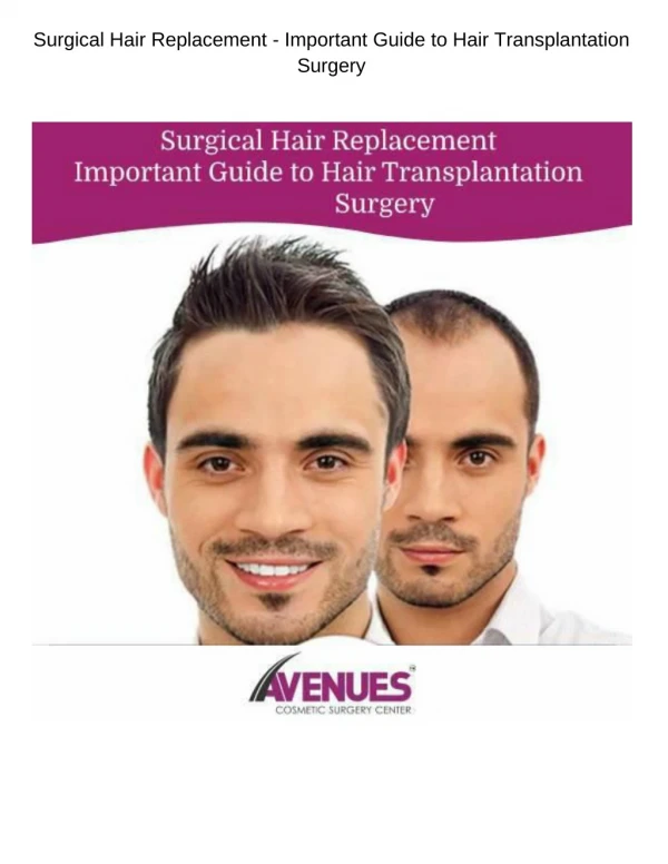 Surgical Hair Replacement - Important Guide to Hair Transplantation Surgery