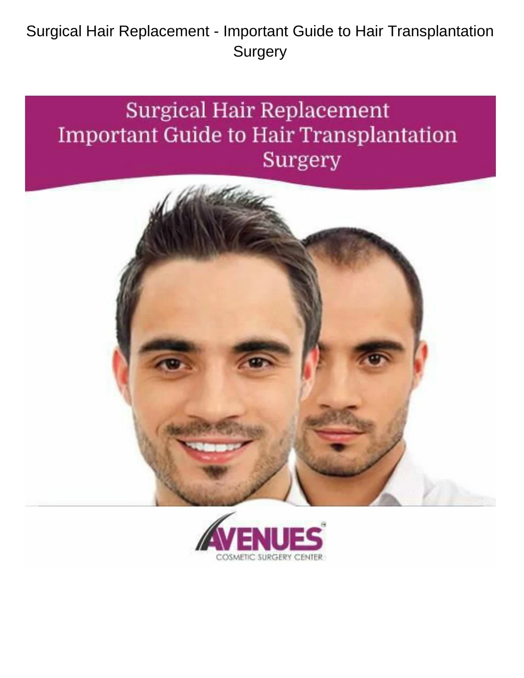 surgical hair replacement important guide to hair