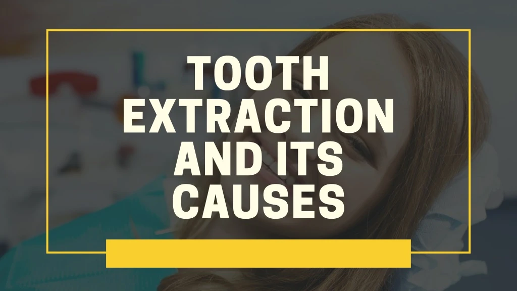 tooth extraction and its causes
