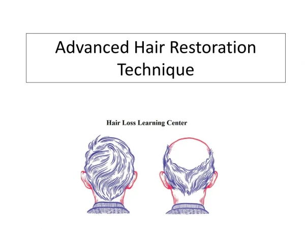 Advanced Hair Restoration Technique