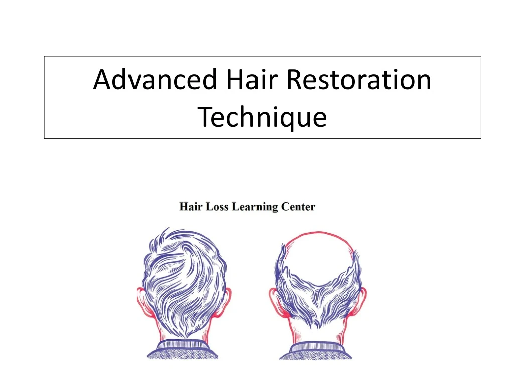 advanced hair restoration technique