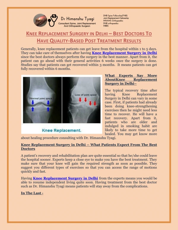Knee Replacement Surgery in Delhi – Best Doctors To Have Quality-Based Post Treatment Results