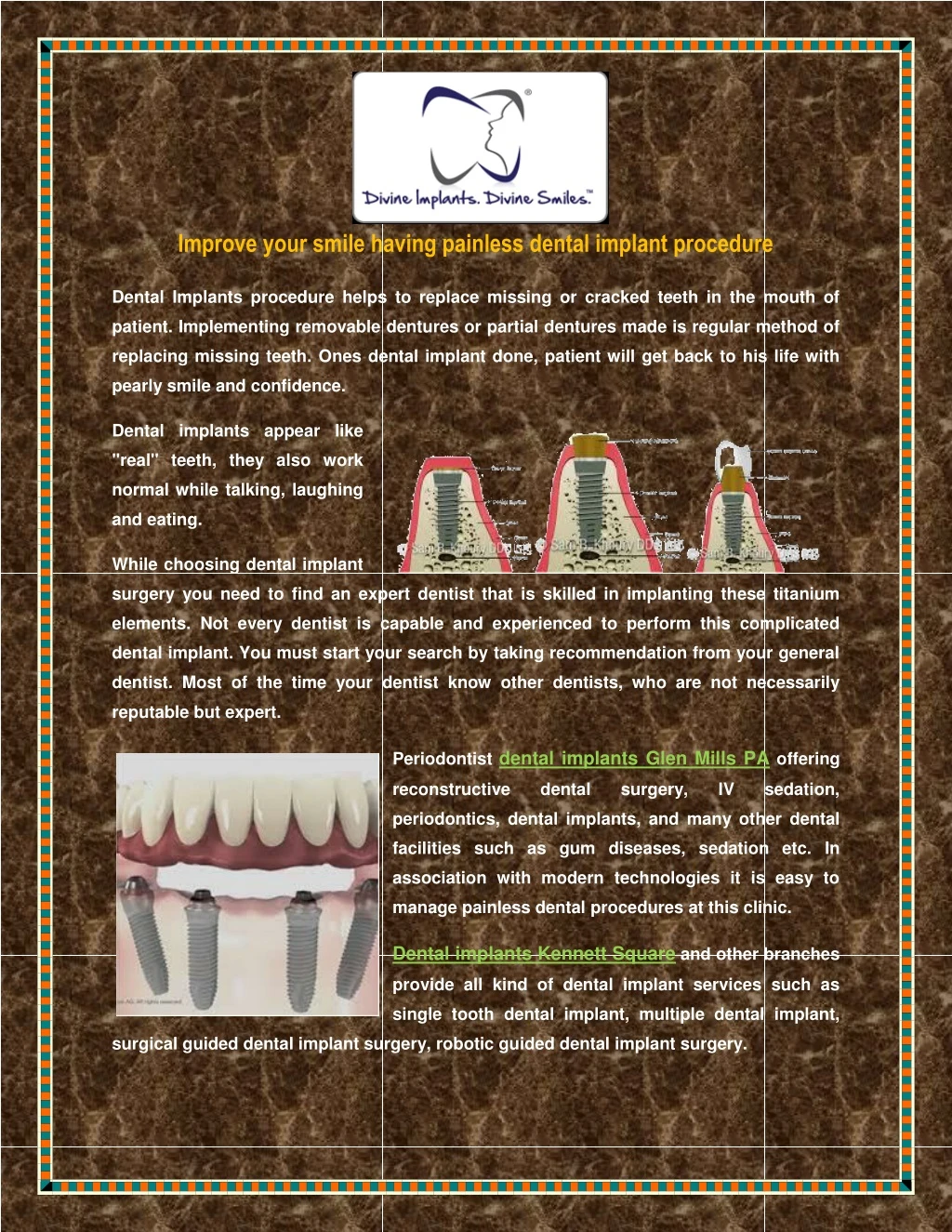 improve your smile having painless dental implant