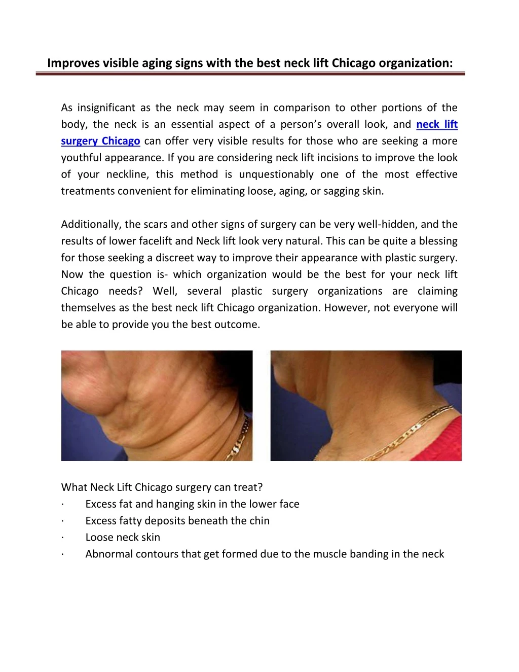 improves visible aging signs with the best neck